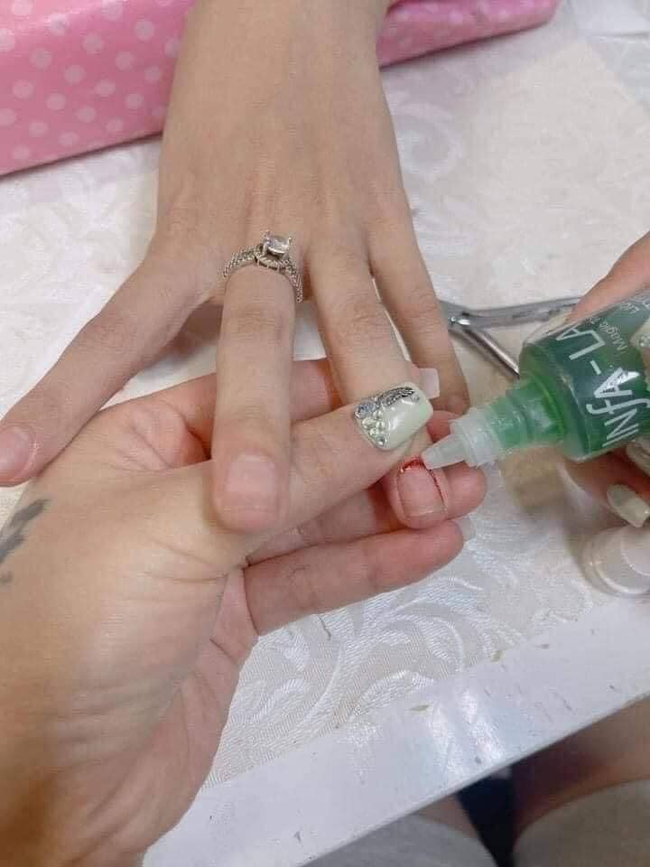 Cầm máu
