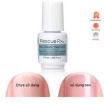 Dưỡng Phục Hồi Móng CND Cao Cấp (RescueRXx) TÁI TẠO MÓNG HƯ TỔN